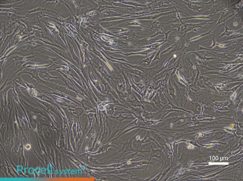 Human Endplate Chondrocyte Complete Medium - 2