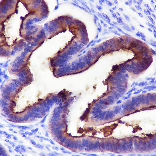 Recombinant MUC1 Monoclonal Antibody - 2