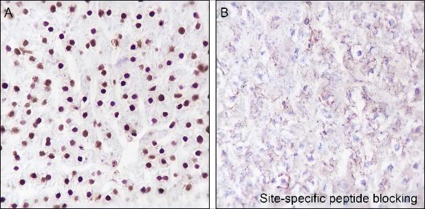 Recombinant Histone H2B (Ubiquityl Lys120) Monoclonal Antibody - small - 4