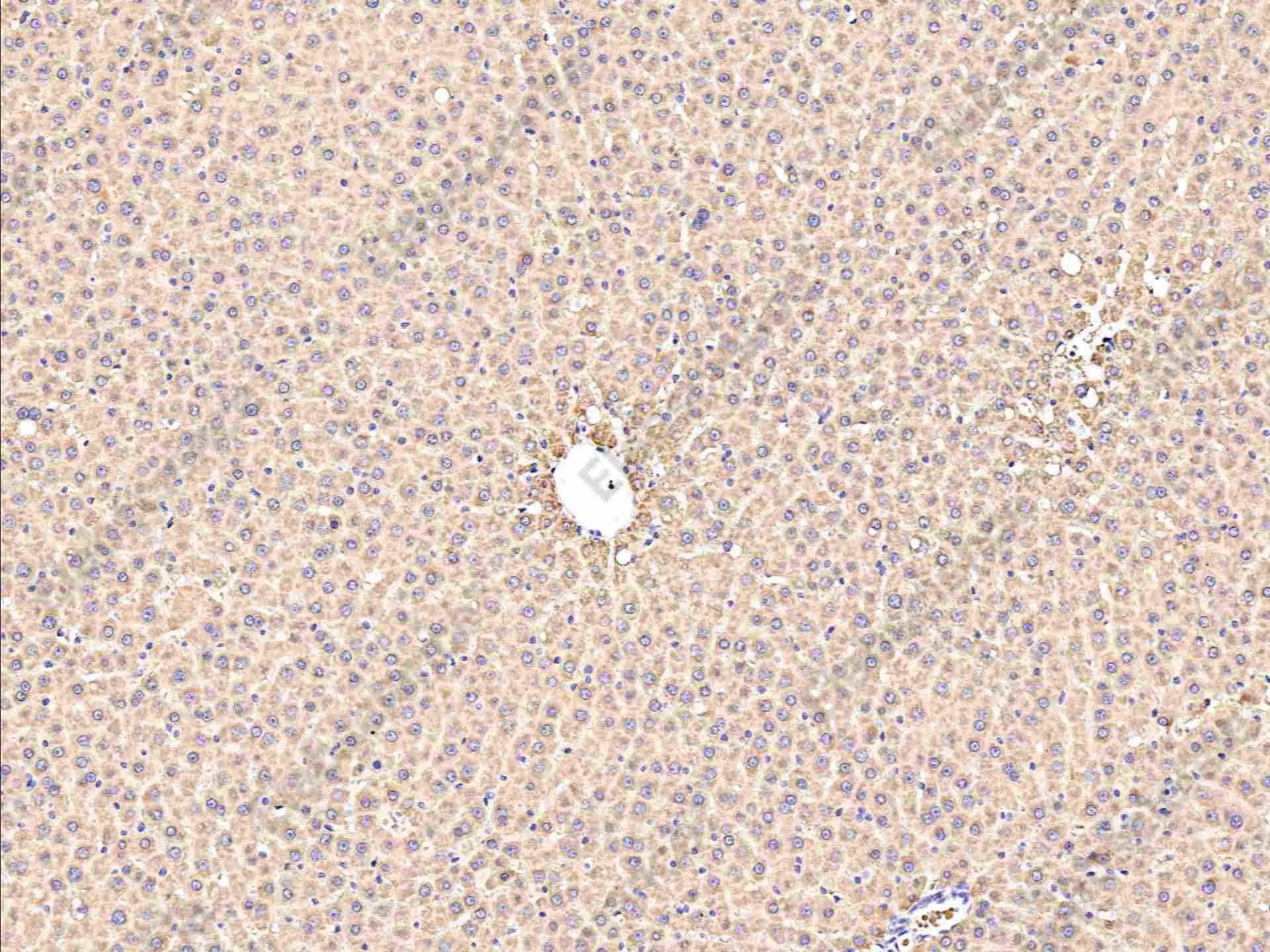 Recombinant ALDH7A1 Monoclonal Antibody - 3