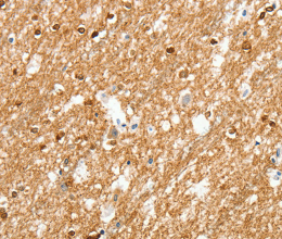 AMZ1 Polyclonal Antibody - 2