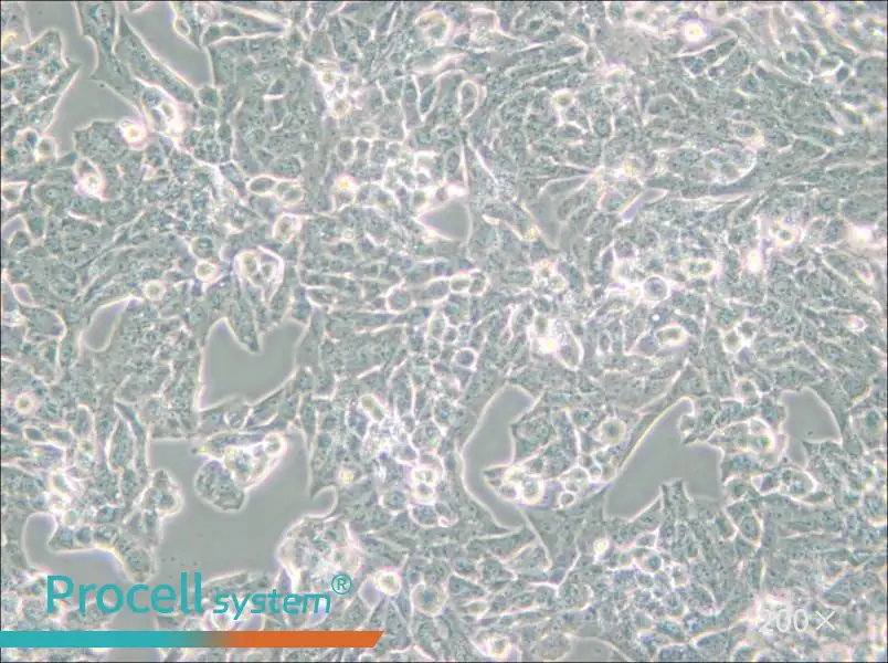 NCI-H295R Cell Complete Medium - small - 5