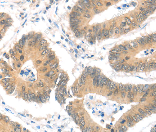 MAGED1 Polyclonal Antibody - 2