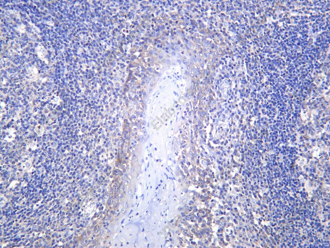 Recombinant BMP 9 Monoclonal Antibody - 2
