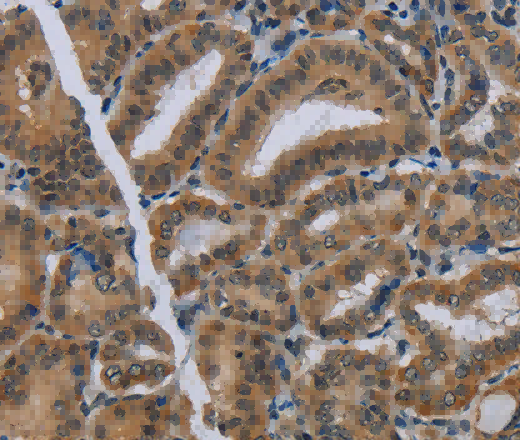 NAT10 Polyclonal Antibody - 3