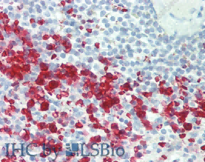 CCL17 Polyclonal Antibody - 4