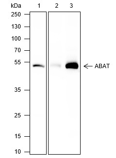 Recombinant ABAT Monoclonal Antibody-searchlist-1
