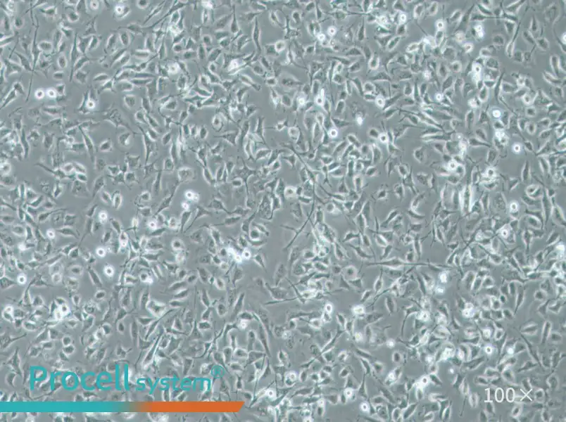 HBE135-E6E7 Cell Complete Medium - 2