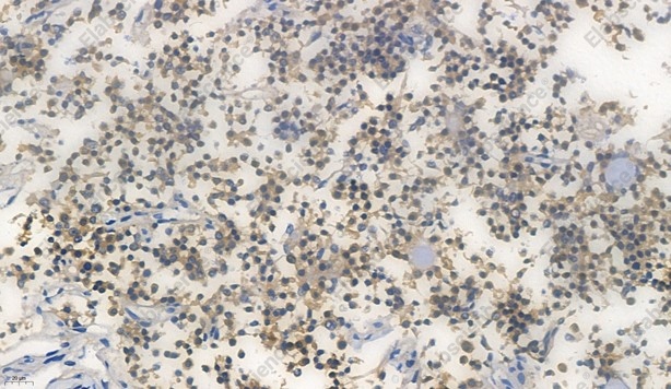 Recombinant Glutathione Peroxidase 4 Monoclonal Antibody - 5