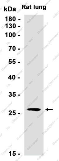 Recombinant Galectin 3 Monoclonal Antibody - 2