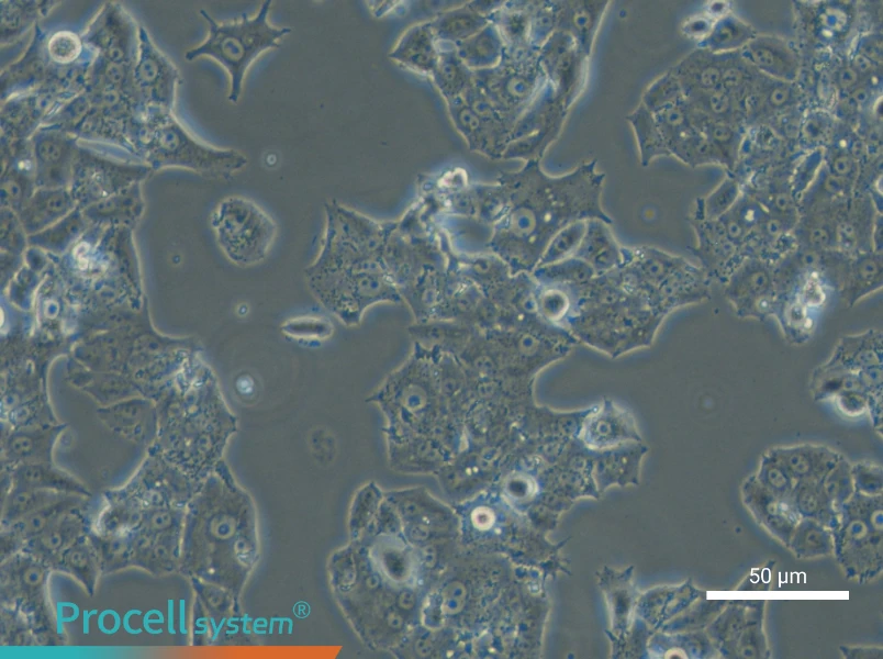 NCI-H1395 - 6