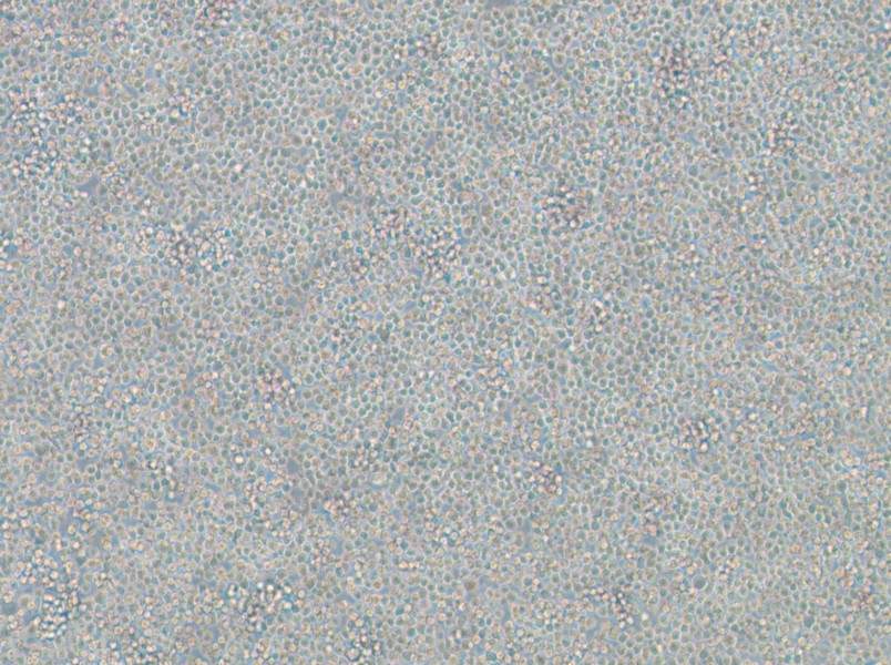 WIL2 S Cell Complete Medium - 2