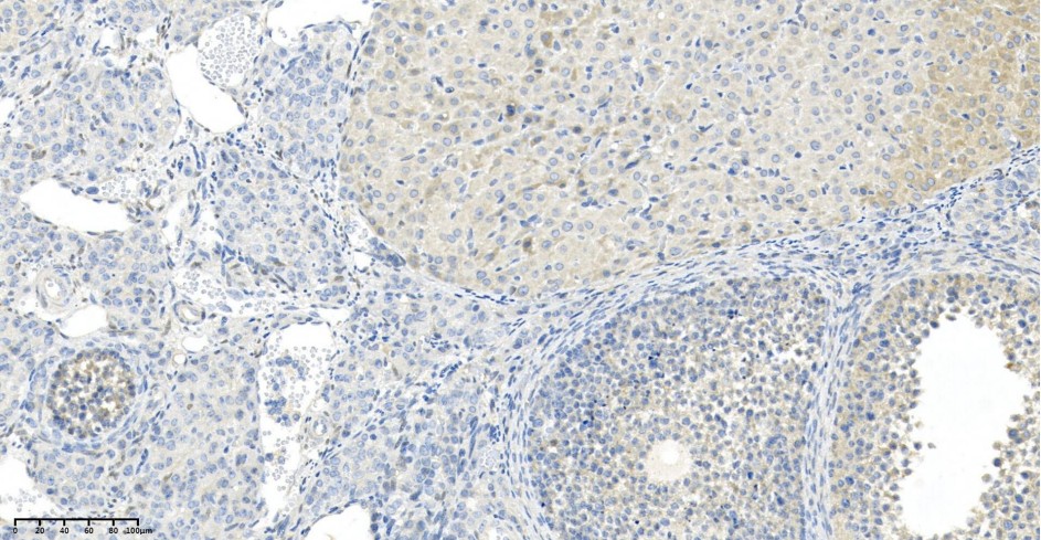 Recombinant Phospho-mTOR (Ser2448) Monoclonal Antibody - small - 2