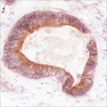 Recombinant FGFR2 Monoclonal Antibody-searchlist-1