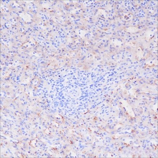 Recombinant CD16a Monoclonal Antibody - 3