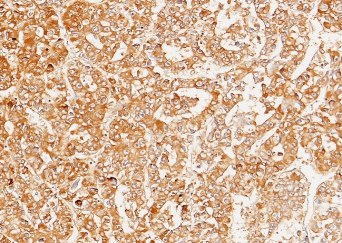Recombinant SerpinD1 Monoclonal Antibody - small - 2