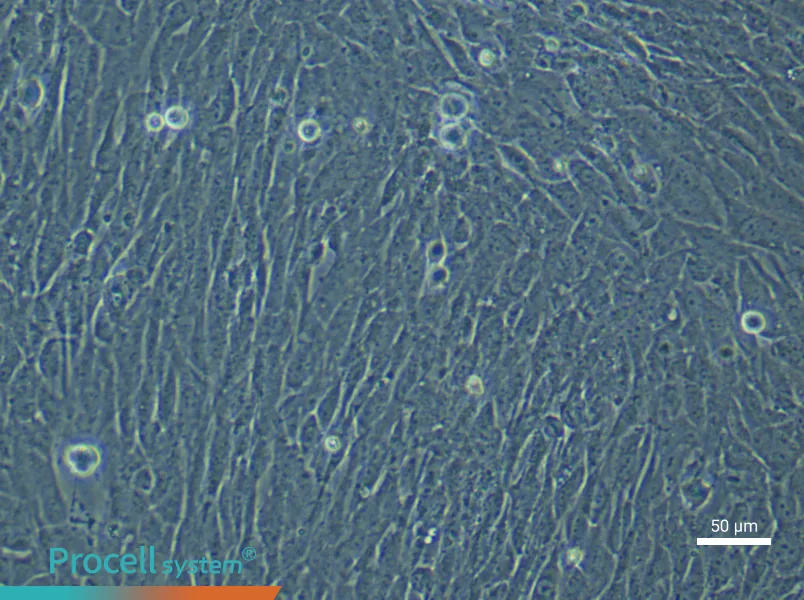 Human Ovarian Cancer Fibroblast (Primary cell immortalization) Complete Medium - 6