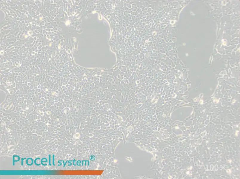 Detroit 562 Cell Complete Medium - 1