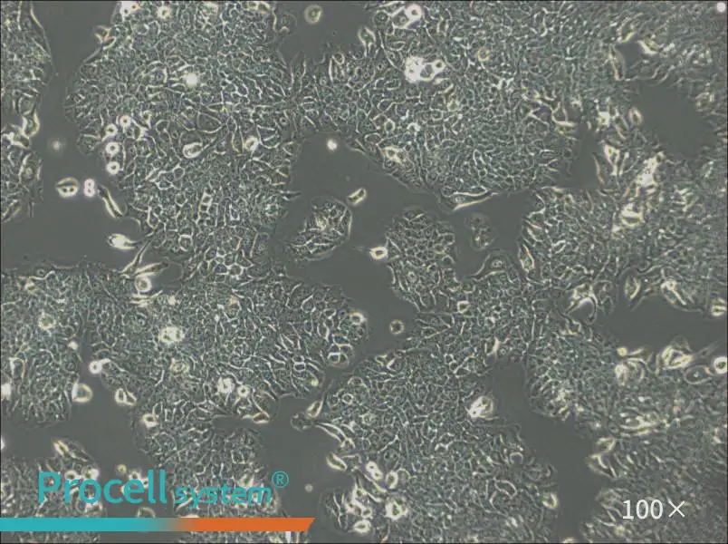 JIMT-1 Cell Complete Medium - 3