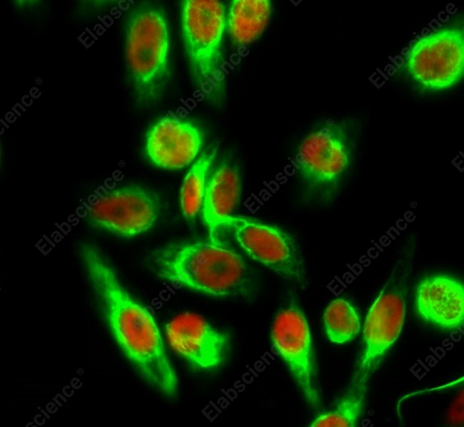 Recombinant Histone H4 (Acetyl Lys5) Monoclonal Antibody - 3
