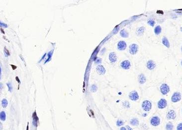 Recombinant COUP-TFII Monoclonal Antibody-searchlist-2