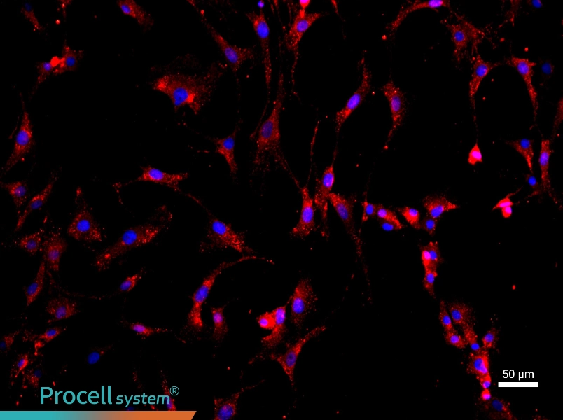 Rat Intervertebral Disc Annulus Fibrosus Cells - 1