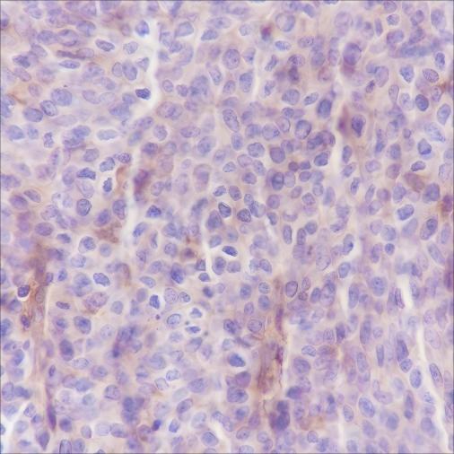 Recombinant B7-H3/CD276 Monoclonal Antibody - 2