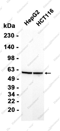 Recombinant Glucose 6 Phosphate Dehydrogenase Monoclonal Antibody - 2