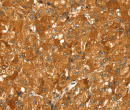 PYGM Polyclonal Antibody - 3