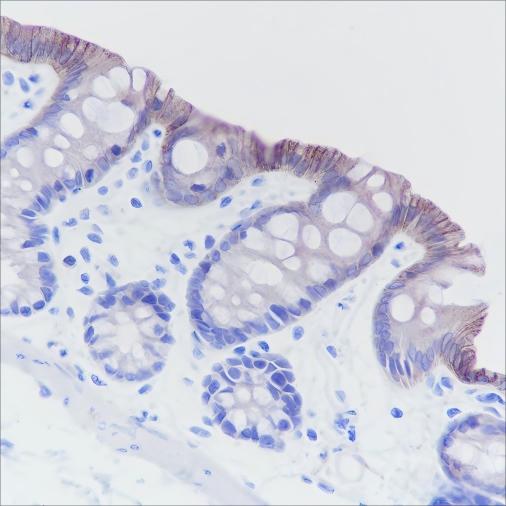 Recombinant Cadherin-17 Monoclonal Antibody - 3