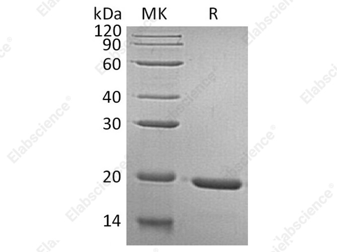 Recombinant Human GH1/Growth hormone 1 Protein - 1
