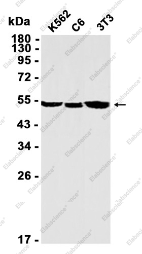Recombinant Cytochrome P450 17A1/CYP17A1 Monoclonal Antibody - 2