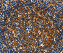GNA13 Polyclonal Antibody - 2