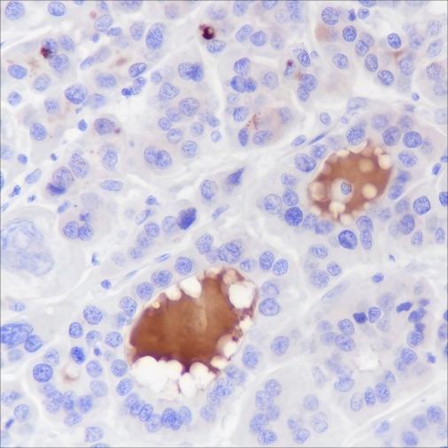 Recombinant Complement C4-B Monoclonal Antibody - small - 3
