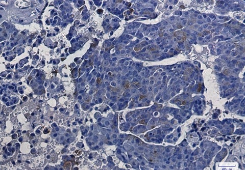 Recombinant ASS1 Monoclonal Antibody - 5