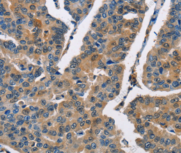 CBR1 Polyclonal Antibody - 2