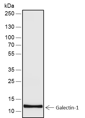 Recombinant Galectin-1 Monoclonal Antibody - 2