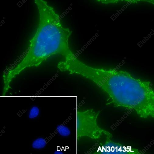 Recombinant alpha smooth muscle Actin Monoclonal Antibody - 6