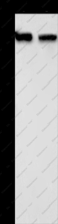 NCAPD2 Polyclonal Antibody - 1