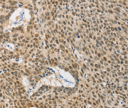 HSP40 Polyclonal Antibody - 2