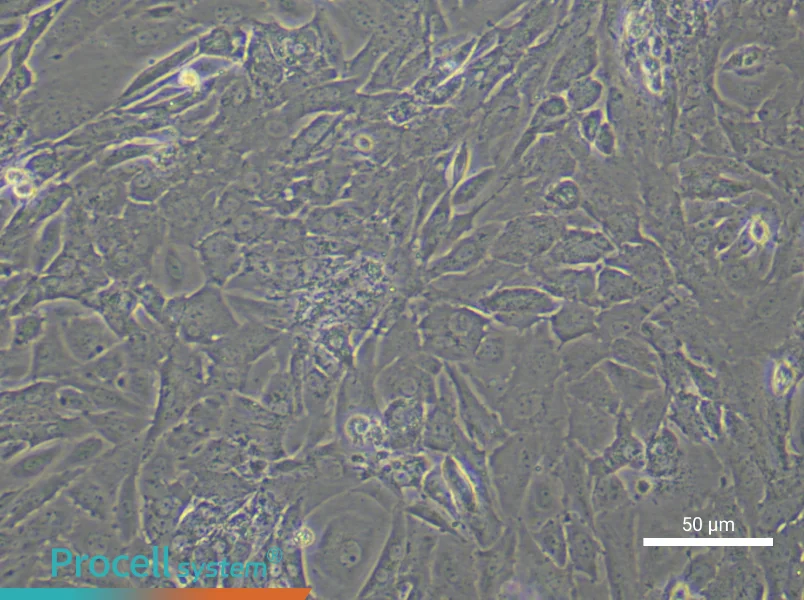 Mouse Ovarian Fibroblasts - 5