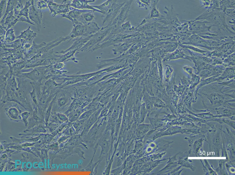 Mouse Pulmonary Artery Smooth Muscle Cell Complete Medium - small - 5