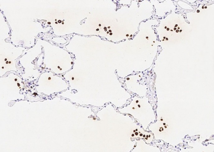 Recombinant IFI30 Monoclonal Antibody - small - 3