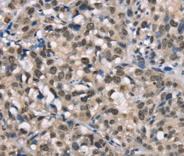 NSMCE3 Polyclonal Antibody - 3