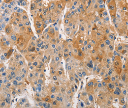 PKC epsilon Polyclonal Antibody - 2