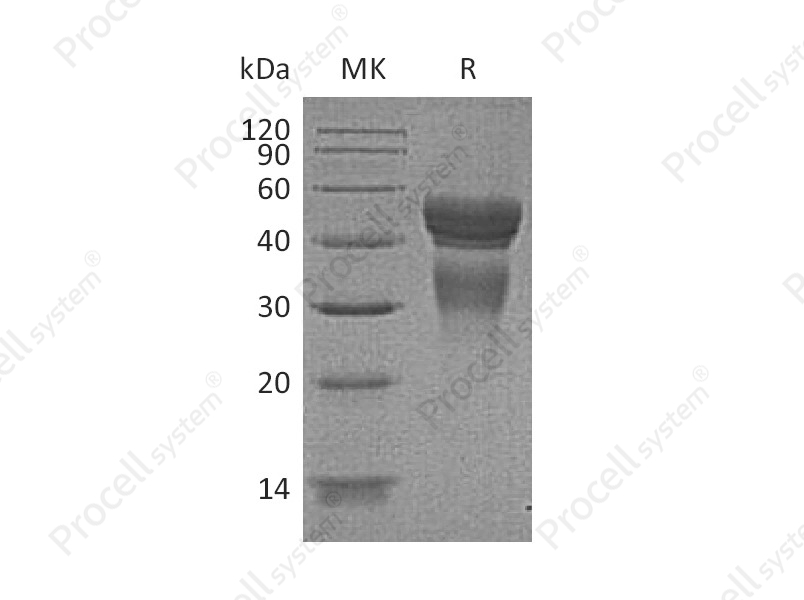 IL-12/IL12A, Human, Recombinant