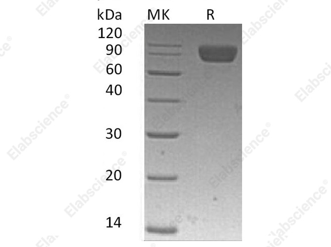 Recombinant Human PDGFRa/CD140a Protein (His Tag) - 1