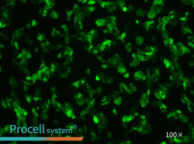 Hep G2-GFPHep G2-GFP - 3