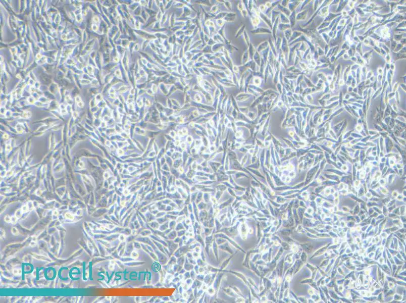 SK-UT-1 Cell Complete Medium - 3