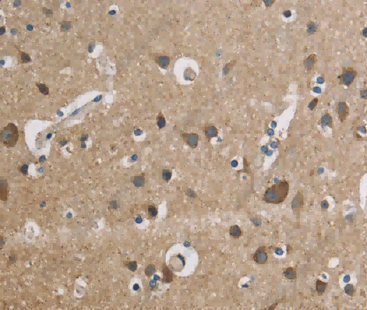 CYCS Polyclonal Antibody - 2